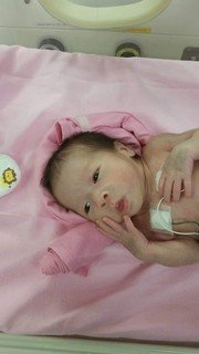 芊熙初生時只有1.4kg，身體虛弱得依賴呼吸機協助呼吸。